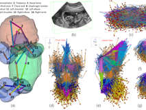 91色情
倪东教授团队在《Medical Image Analysis》上发表文章