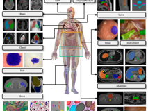 91色情
倪东教授团队在《Medical Image Analysis》上发表文章